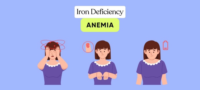 Iron Deficiency (Anemia)