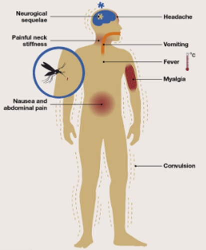 Japanese Encephalitis