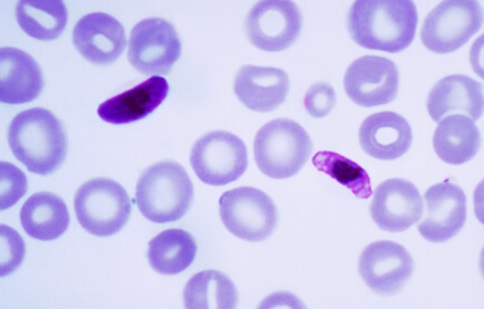 Pathogens That Cause Malaria