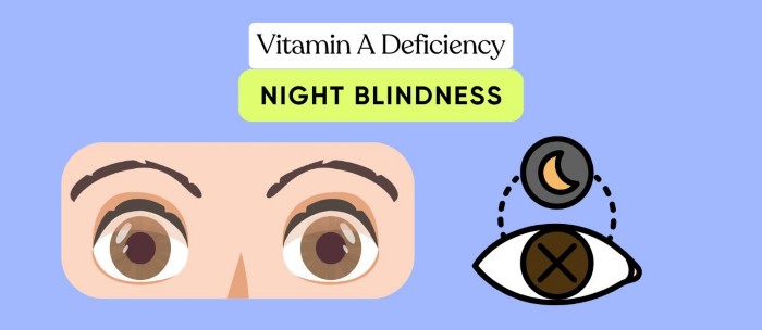 Vitamin A Deficiency (Night Blindness)